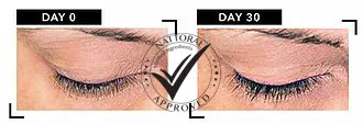Eyelash Growth Serum for thin weak eyelashes - 6ml- Biobalance